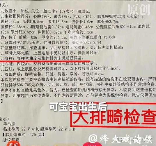 产检正常生出畸形儿！漏诊先天性脊柱畸形，医生调离岗位，副院长立案调查